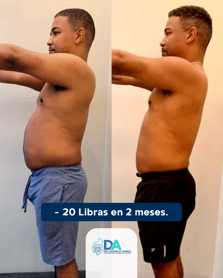 Antes y después: 20 libras menos en 2 meses