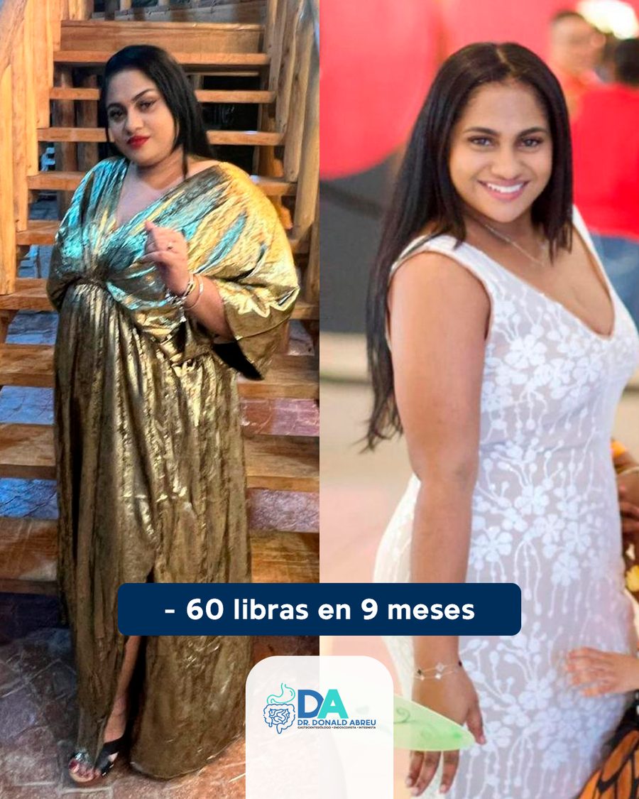 Antes y después: 60 libras menos en 9 meses