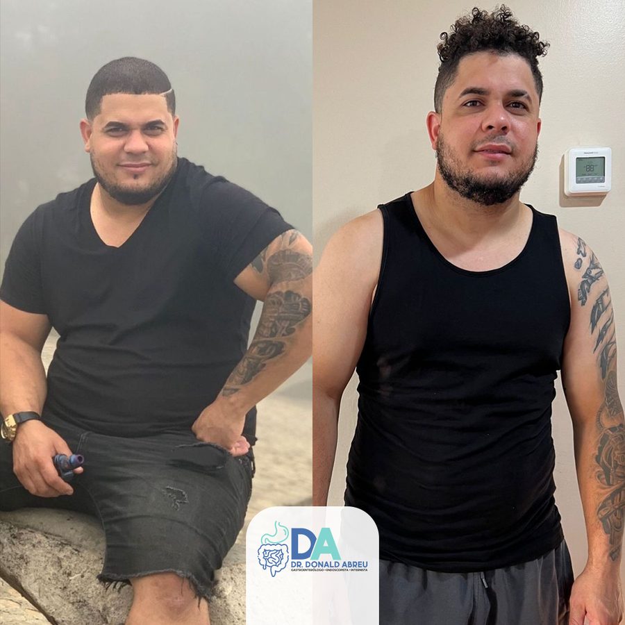 Antes y después de paciente