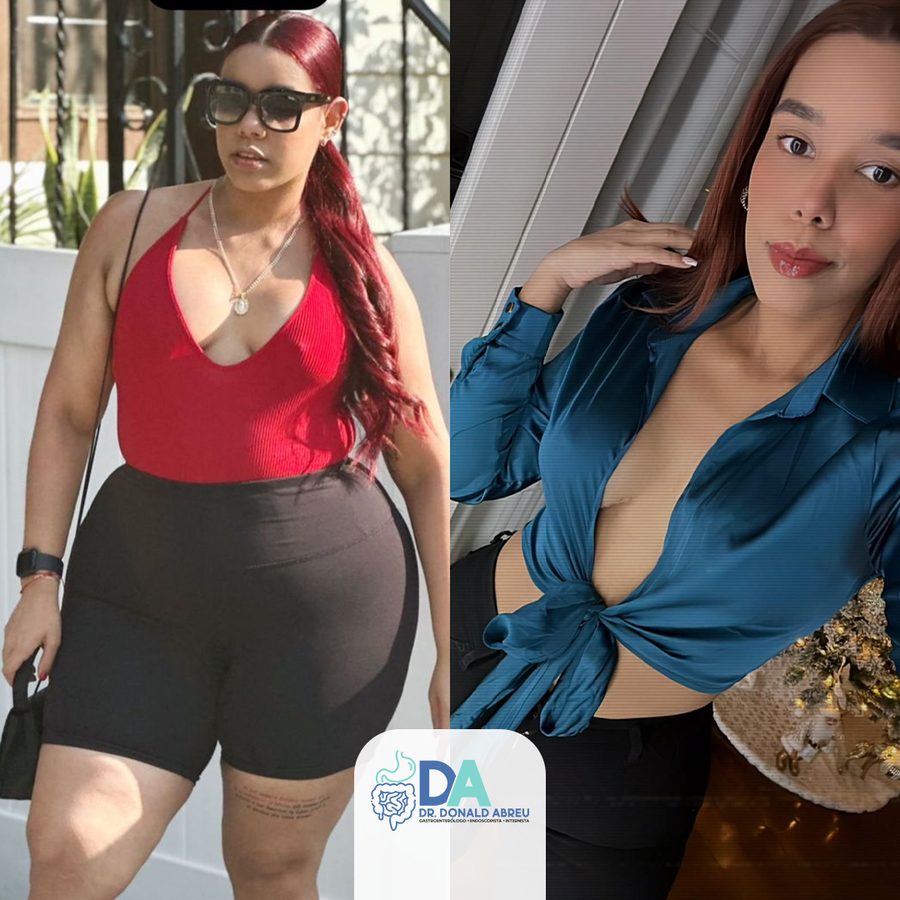 Antes y después de paciente
