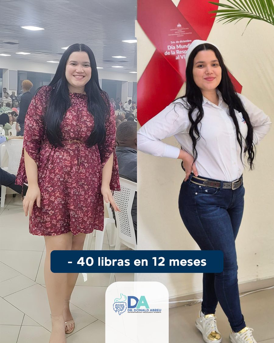 Antes y después: 40 libras menos en 12 meses