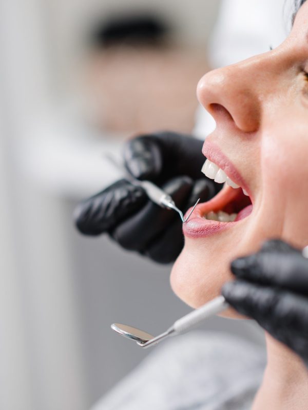 Headshot of a woman during dental checkup.